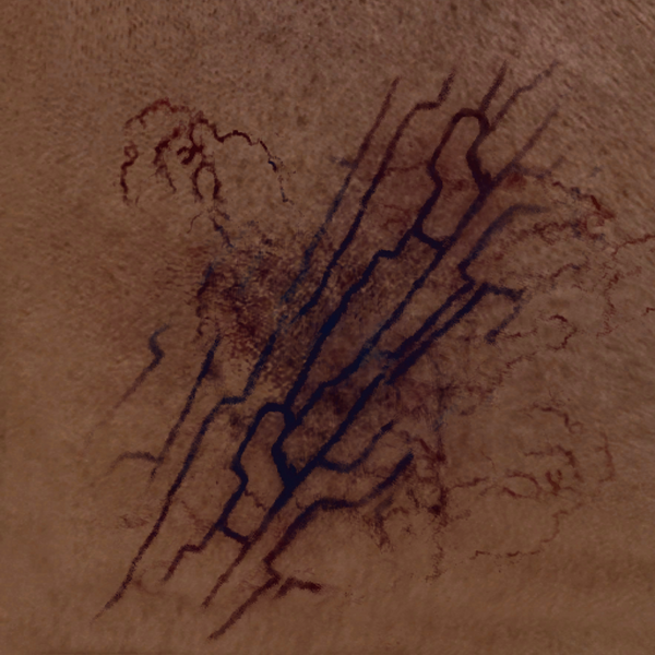 File:ACV ISU BIRTHMARK.png