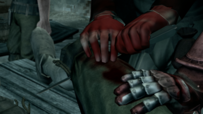 File:That's Gonna Leave a Mark 9.png