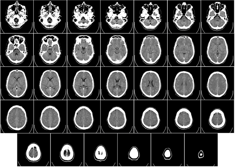 File:AC2 - Brain tomography.png