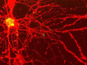 AC2 - Neural network.jpg