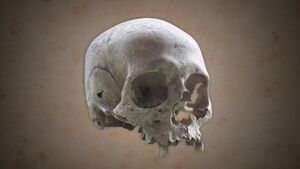 DTVA - Human skull.jpg