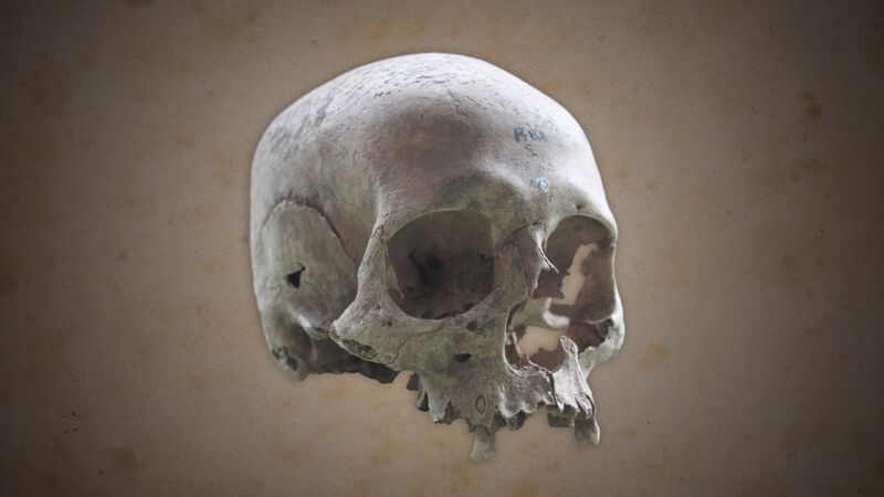 File:DTVA - Human skull.jpg