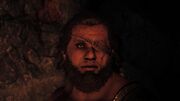 Polyphemos, another man with an eye patch